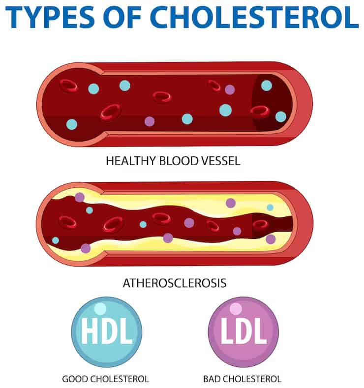 How To Lower Cholesterol in 7 Days