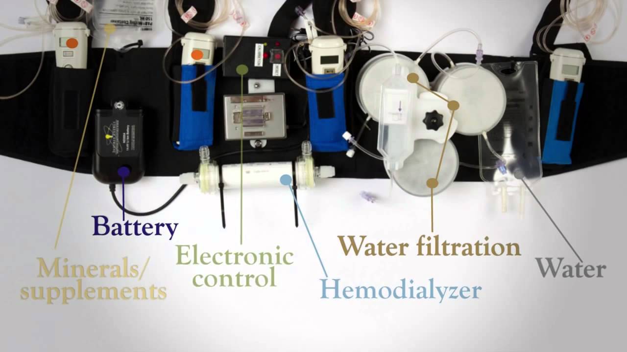 Wearable Artificial Kidney May Replace Dialysis